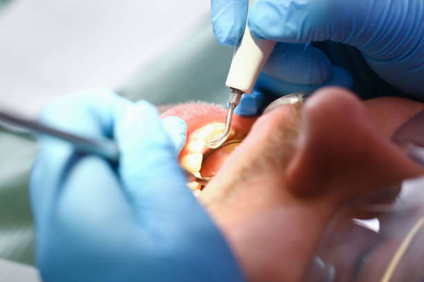 Best Emergency Tooth Extraction in Lavaca, AR