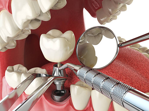 Best Emergency Gum Treatment in Lavaca, AR